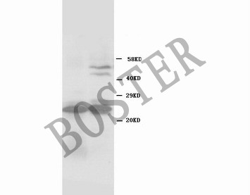 BCL-2(BA0412)(MW:26KD)大鼠肝脏与脾脏组织裂解，免疫印迹分析。