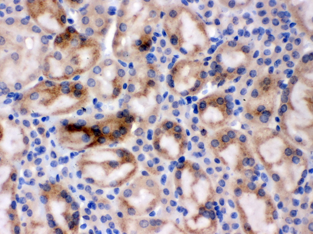 dapk1(ba3712-1)小鼠肾标本,石蜡切片,sabc法,dab显色.