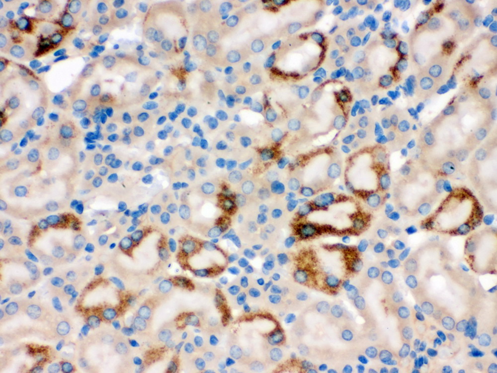 calcineurinβ(bm0677)小鼠肾标本,石蜡切片,sabc法,dab显色.