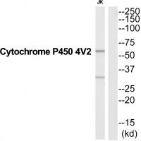 Western blot analysis of extracts from Jurkat cells, using CYP4V2 antibody A05648.