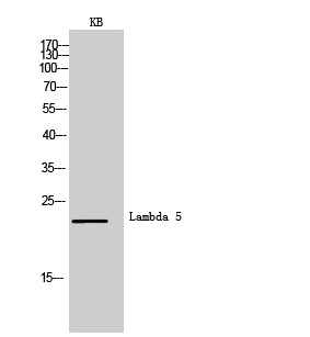 Western Blot (WB) analysis of KB cells using Lambda 5 Polyclonal antibody.