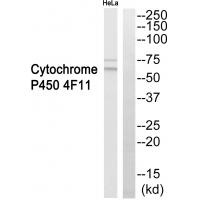 Western blot analysis of extracts from HeLa cells, using Cytochrome P450 4F11 antibody A09078.