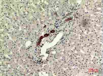 Immunohistochemistry (IHC) analysis of paraffin-embedded Human Liver, antibody was diluted at 1:100.