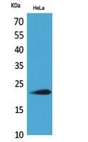 Western Blot (WB) analysis of HeLa cells using IFN-omega Polyclonal antibody.