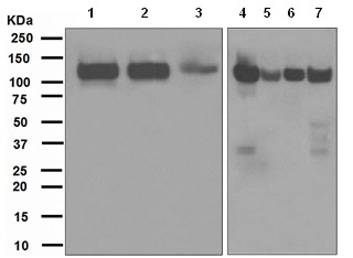 Western blot - BCAR1 antibody [EPR1850(2)] (ab108320)