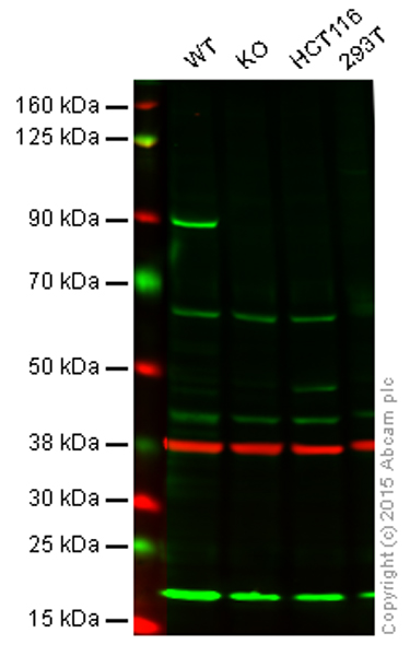 Western blot - Anti-MLH1 antibody [EPR3893] (ab108622)