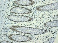 Immunohistochemistry (Formalin/PFA-fixed paraffin-embedded sections) - HAUSP / USP7 antibody [EPR4253] (ab108931)