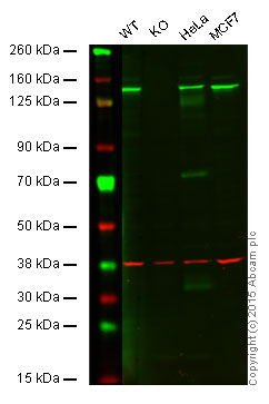 Western blot - Anti-HAUSP / USP7 antibody [EPR4253] (ab108931)