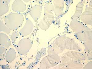 Immunohistochemistry (Formalin/PFA-fixed paraffin-embedded sections)-Anti-LI Cadherin antibody [EPR3996](ab109190)