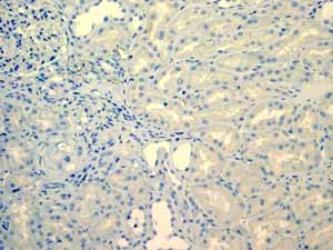 Immunohistochemistry (Formalin/PFA-fixed paraffin-embedded sections)-Anti-LI Cadherin antibody [EPR3996](ab109190)