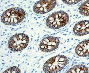 Immunohistochemistry (Formalin/PFA-fixed paraffin-embedded sections)-Anti-LI Cadherin antibody [EPR3996](ab109190)