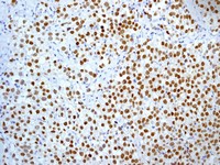 Immunohistochemistry (Formalin/PFA-fixed paraffin-embedded sections) - Anti-Nanog antibody [EPR2027(2)] (ab109250)