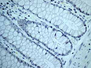 Immunohistochemistry (Formalin/PFA-fixed paraffin-embedded sections) - Anti-Nanog antibody [EPR2027(2)] (ab109250)