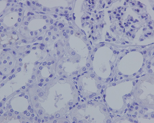 Immunohistochemistry (Formalin/PFA-fixed paraffin-embedded sections) - Anti-Nanog antibody [EPR2027(2)] (ab109250)