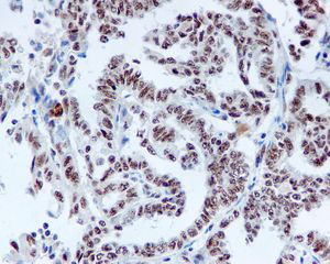 Immunohistochemistry (Formalin/PFA-fixed paraffin-embedded sections) - DDX50 antibody [EPR5273] (ab109515)