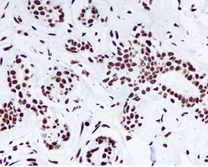 Immunohistochemistry (Formalin/PFA-fixed paraffin-embedded sections) - Nucleophosmin (phospho S125) antibody [EPR1856] (ab109546)