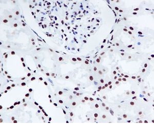 Immunohistochemistry (Formalin/PFA-fixed paraffin-embedded sections) - Nucleophosmin (phospho S125) antibody [EPR1856] (ab109546)