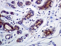 Immunohistochemistry (Formalin/PFA-fixed paraffin-embedded sections) - FNTB antibody [EPR4707] (ab109625)