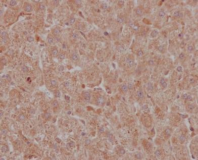 Immunohistochemistry (Formalin/PFA-fixed paraffin-embedded sections) - Anti-NAK/TBK1  antibody [EPR2867(2)-19] (ab109735)