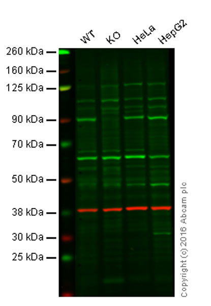 Western blot - Anti-NAK/TBK1  antibody [EPR2867(2)-19] (ab109735)
