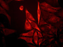 Immunocytochemistry/ Immunofluorescence - Anti-NDRG1 antibody [EPR5593] (ab124689)