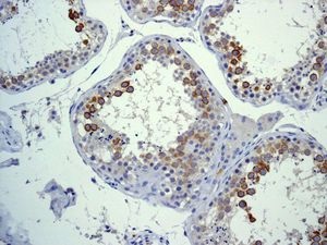 Immunohistochemistry (Formalin/PFA-fixed paraffin-embedded sections) - Anti-CD168 antibody [EPR4054] (ab124729)