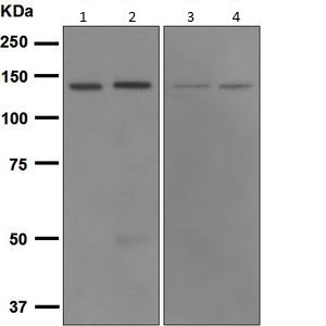 Western blot - Anti-CARD11 antibody [EPR2557] (ab124730)