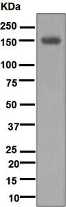 Western blot - Anti-Desmoglein 1 antibody [EPR6766(B)] (ab124798)