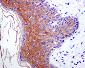 Immunohistochemistry (Formalin/PFA-fixed paraffin-embedded sections) - Anti-Desmoglein 1 antibody [EPR6766(B)] (ab124798)