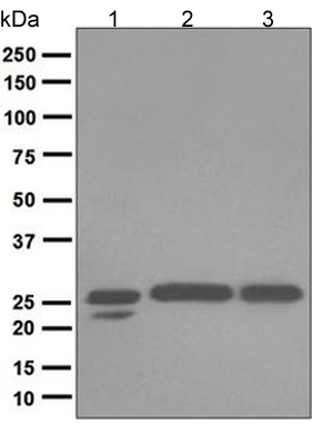 Western blot - Anti-COMT antibody [EPR6491(B)] (ab124813)