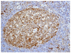 Immunohistochemistry (Formalin/PFA-fixed paraffin-embedded sections) - Anti-Cdk6 antibody [EPR4515] (ab124821)