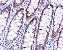 Immunohistochemistry (Formalin/PFA-fixed paraffin-embedded sections) - Anti-NUP98 antibody [EPR6678] (ab124980)