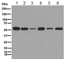 Western blot - Anti-LMAN1 antibody [EPR6979] (ab125006)