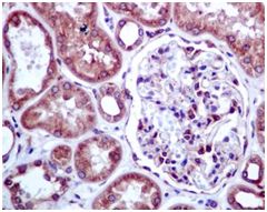 Immunohistochemistry (Formalin/PFA-fixed paraffin-embedded sections) - Anti-LMAN1 antibody [EPR6979] (ab125006)