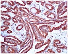 Immunohistochemistry (Formalin/PFA-fixed paraffin-embedded sections) - Anti-LMAN1 antibody [EPR6979] (ab125006)