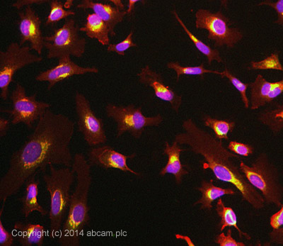 Immunocytochemistry/ Immunofluorescence - Anti-LMAN1 antibody [EPR6979] (ab125006)