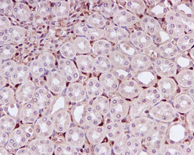 Immunohistochemistry (Formalin/PFA-fixed paraffin-embedded sections) - Anti-DUSP3 antibody [EPR5492] (ab125077)