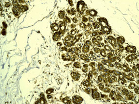 Immunohistochemistry (Formalin/PFA-fixed paraffin-embedded sections) - Anti-LPP antibody [EPR6478] (ab126608)