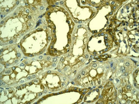 Immunohistochemistry (Formalin/PFA-fixed paraffin-embedded sections) - Anti-LPP antibody [EPR6478] (ab126608)