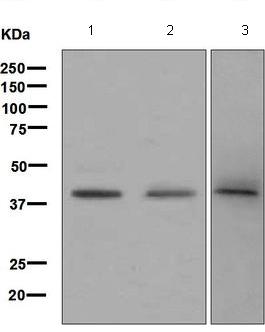 Western blot - Anti-Blood Group Antigen Precursor antibody [EPR6205] (ab126612)