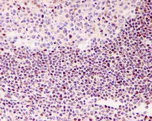 Immunohistochemistry (Formalin/PFA-fixed paraffin-embedded sections) - Anti-Bmi1 antibody [EPR3745(2)] (ab126783)