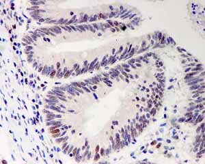 Immunohistochemistry (Formalin/PFA-fixed paraffin-embedded sections) - Anti-Bmi1 antibody [EPR3745(2)] (ab126783)