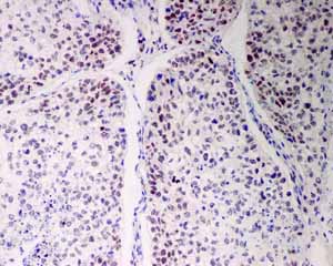 Immunohistochemistry (Formalin/PFA-fixed paraffin-embedded sections) - Anti-Bmi1 antibody [EPR3745(2)] (ab126783)