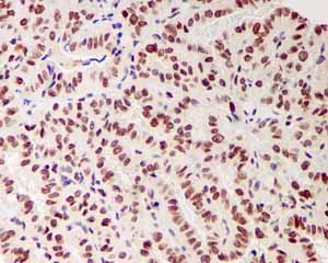 Immunohistochemistry (Formalin/PFA-fixed paraffin-embedded sections) - Anti-Bmi1 antibody [EPR3745(2)] (ab126783)