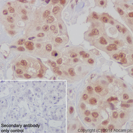 Immunohistochemistry (Formalin/PFA-fixed paraffin-embedded sections) - Anti-Bmi1 antibody [EPR3745(2)] (ab126783)