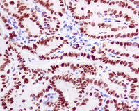 Immunohistochemistry (Formalin/PFA-fixed paraffin-embedded sections) - Anti-CTBP2 antibody [EPR7611(B)] (ab128871)