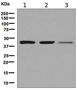 Western blot - Anti-ACAA2 antibody [EPR6732(2)] (ab128929)