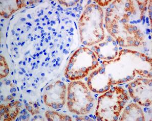 Immunohistochemistry (Formalin/PFA-fixed paraffin-embedded sections) - Anti-ACAA2 antibody [EPR6732(2)] (ab128929)