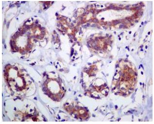 Immunohistochemistry (Formalin/PFA-fixed paraffin-embedded sections) - Anti-AP2S1 antibody [EPR2697(2)] (ab128950)