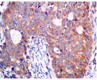 Immunohistochemistry (Formalin/PFA-fixed paraffin-embedded sections) - Anti-AP2S1 antibody [EPR2697(2)] (ab128950)